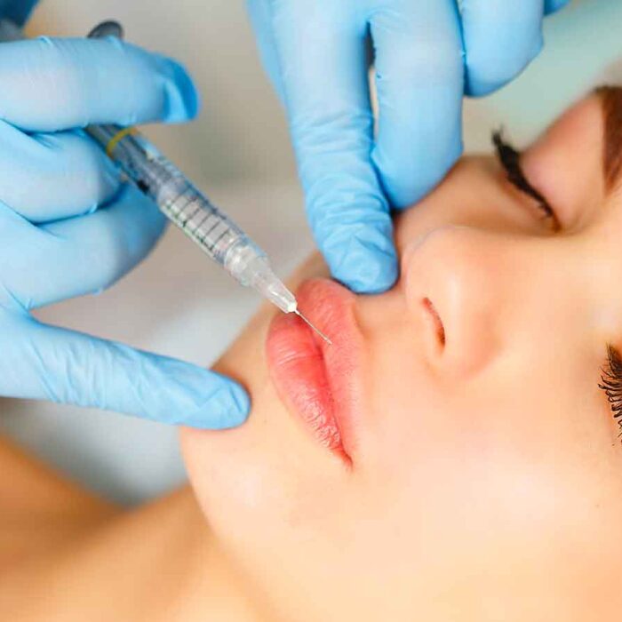 botox_filler_estetica pacc poliambulatorio collecchio Parma
