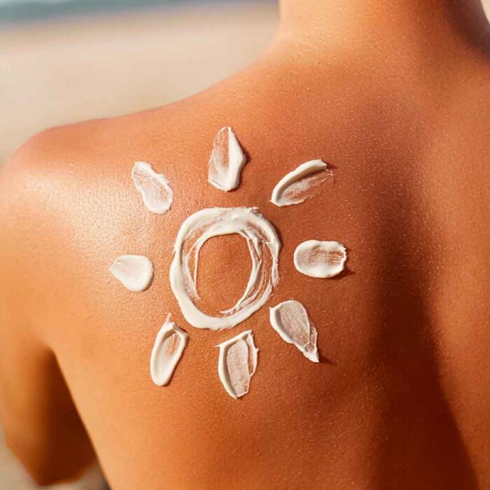 eritema solare pacc poliambulatorio collecchio parma