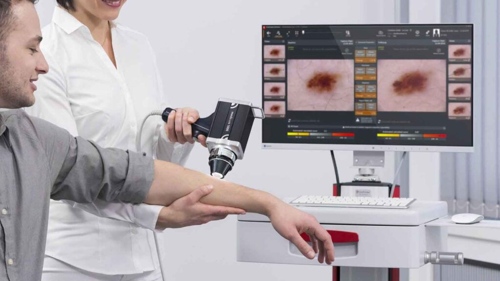 melanoma pacc poliambulatorio collecchio parma