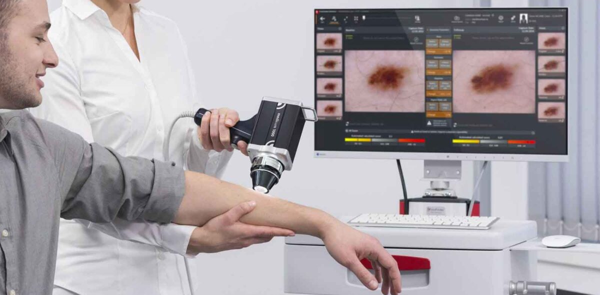 melanoma pacc poliambulatorio collecchio parma