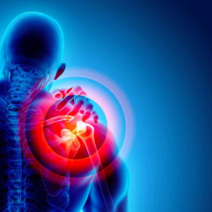 ortopedia onde urto pacc poliambulatorio collecchio parma