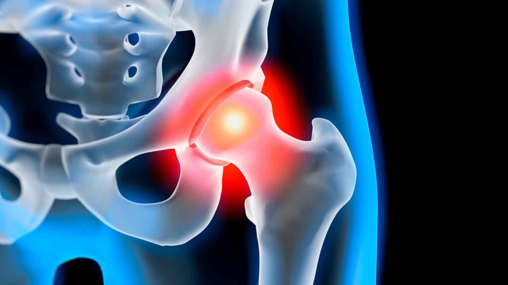 ortopedia pacc poliambulatorio collecchio parma