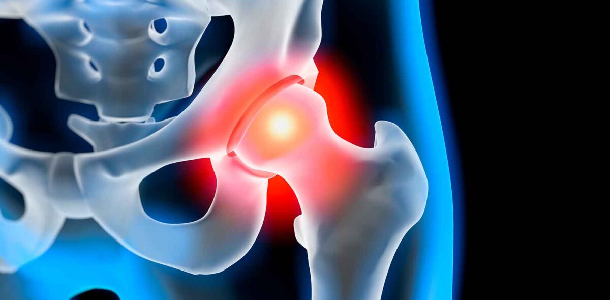 ortopedia pacc poliambulatorio collecchio parma