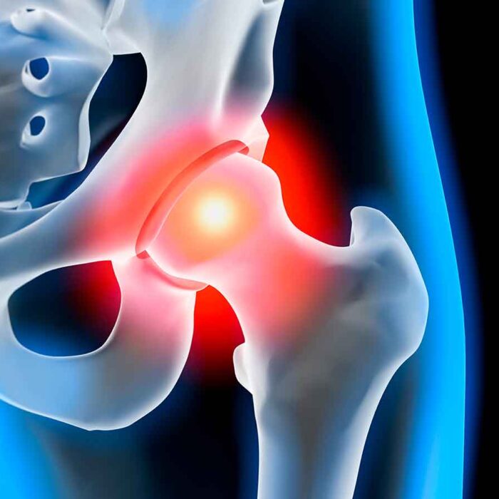 ortopedia pacc poliambulatorio collecchio parma