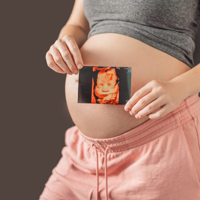 ecografia ostetrica poliambulatorio collecchio