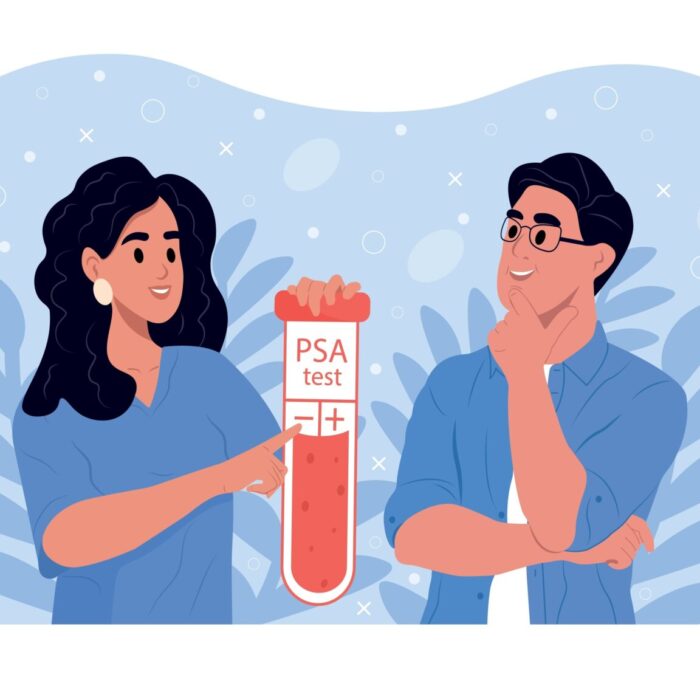 A luglio test PSA gratuito